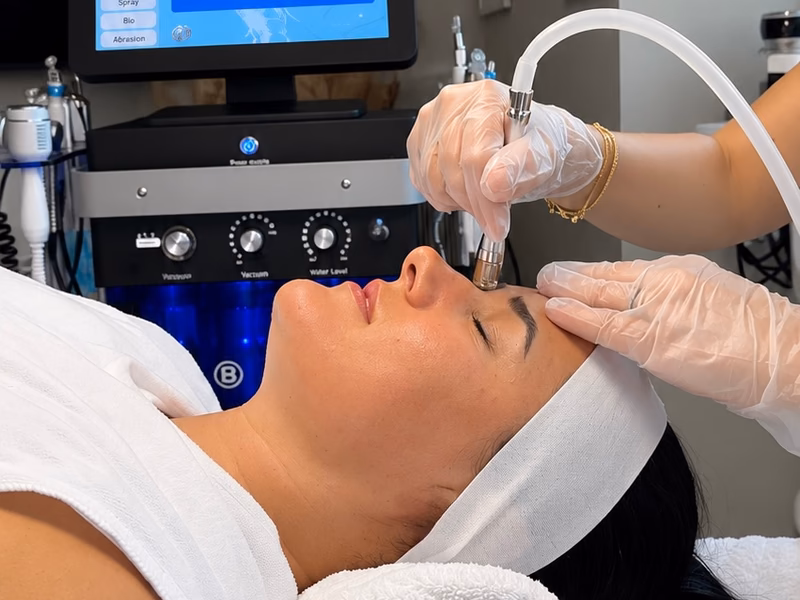 A practitioner performing microdermabrasion on a client’s face