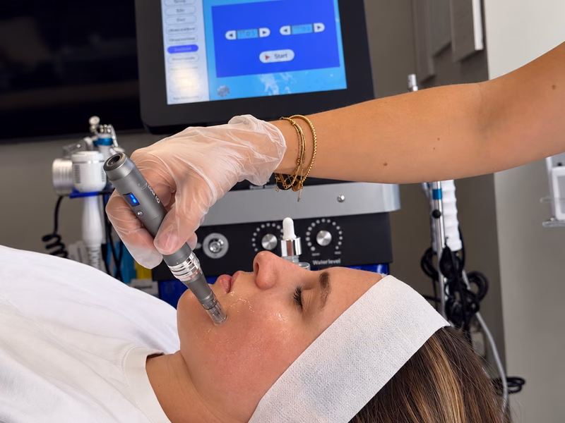 A practitioner performing microneedling on a client’s face
